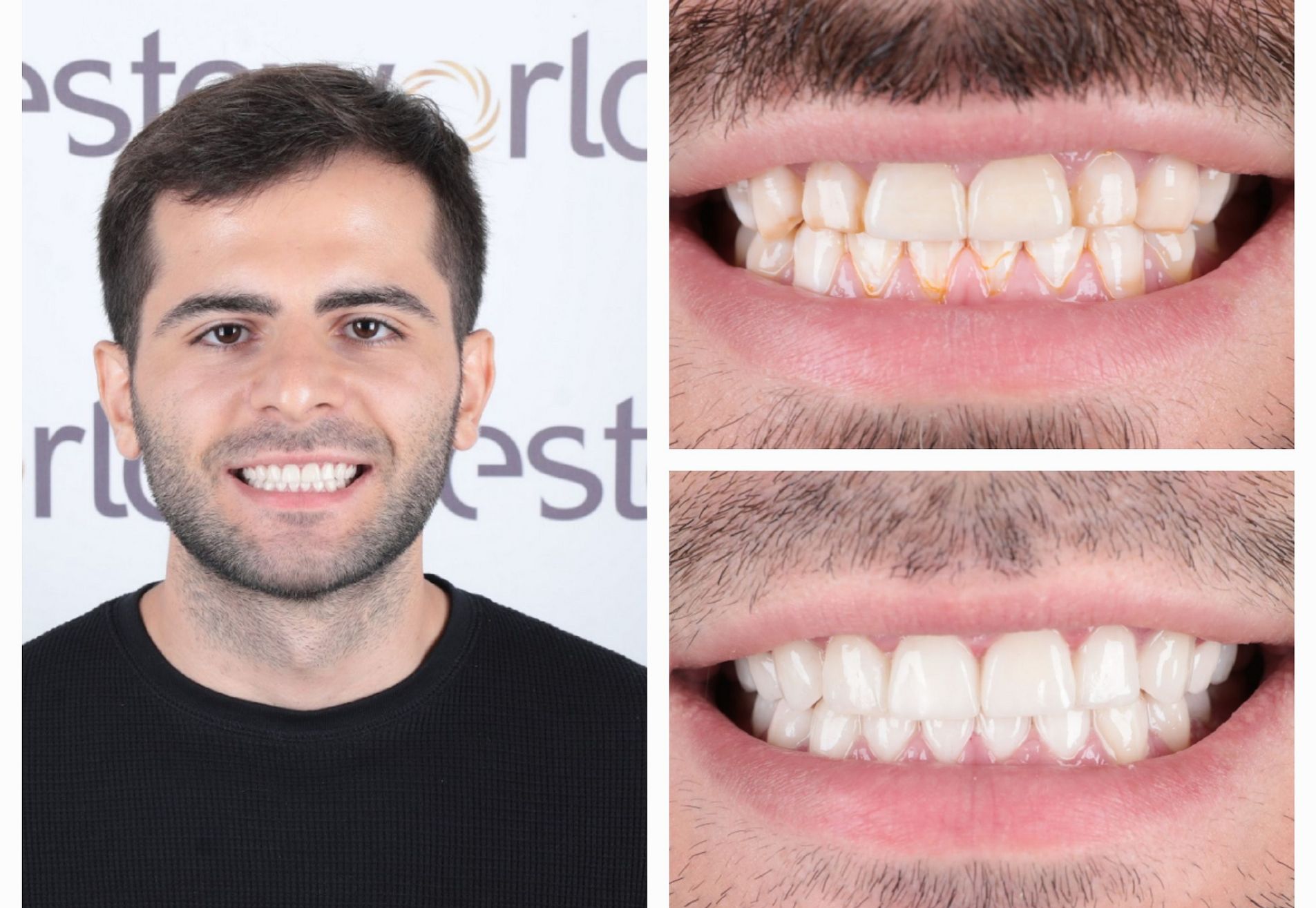 Viktor, eindelijk de uitstraling die ik wil