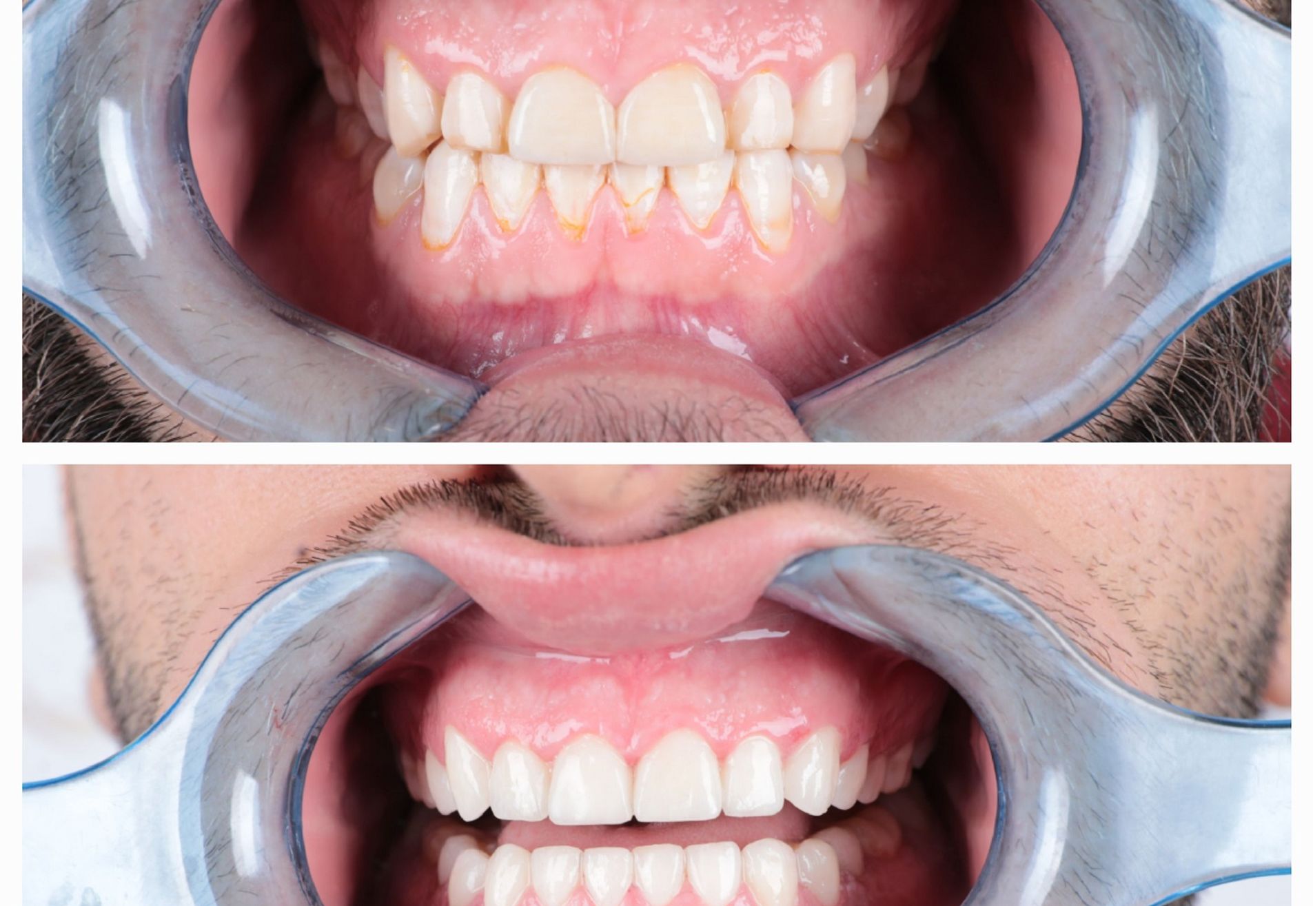 Viktor, eindelijk de uitstraling die ik wil