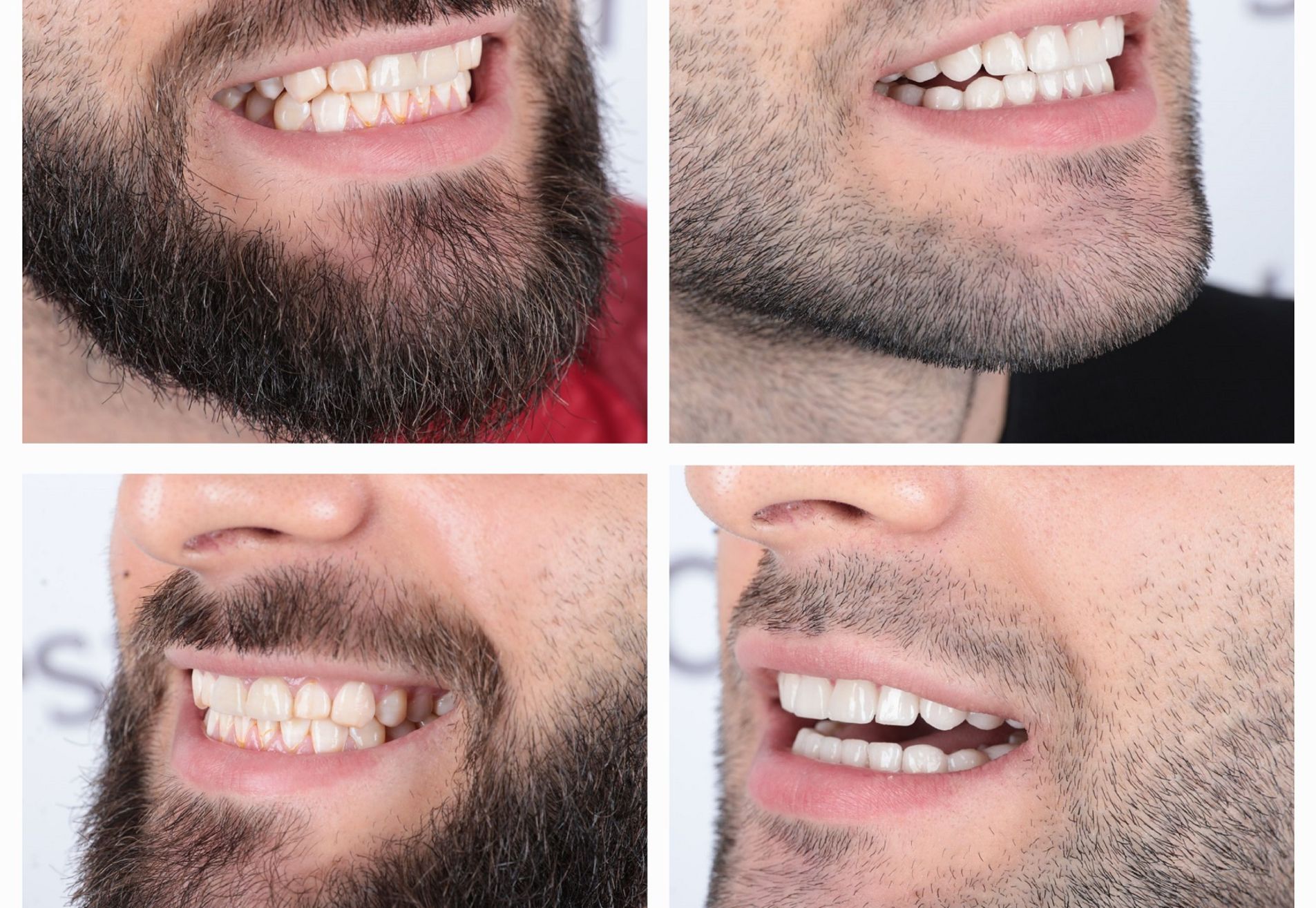 Viktor, eindelijk de uitstraling die ik wil