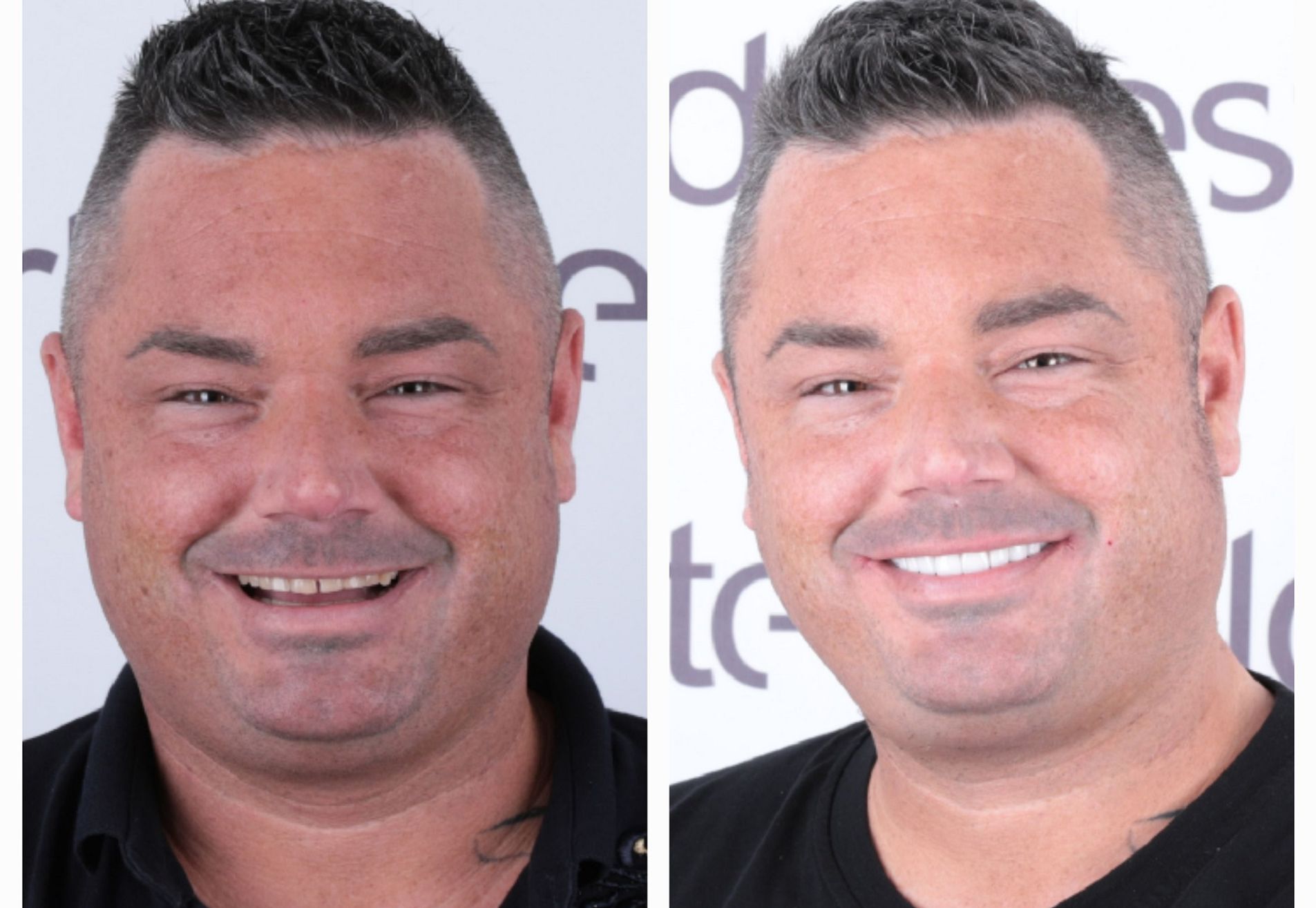 Brian, ik heb eindelijk die Hollywood Smile