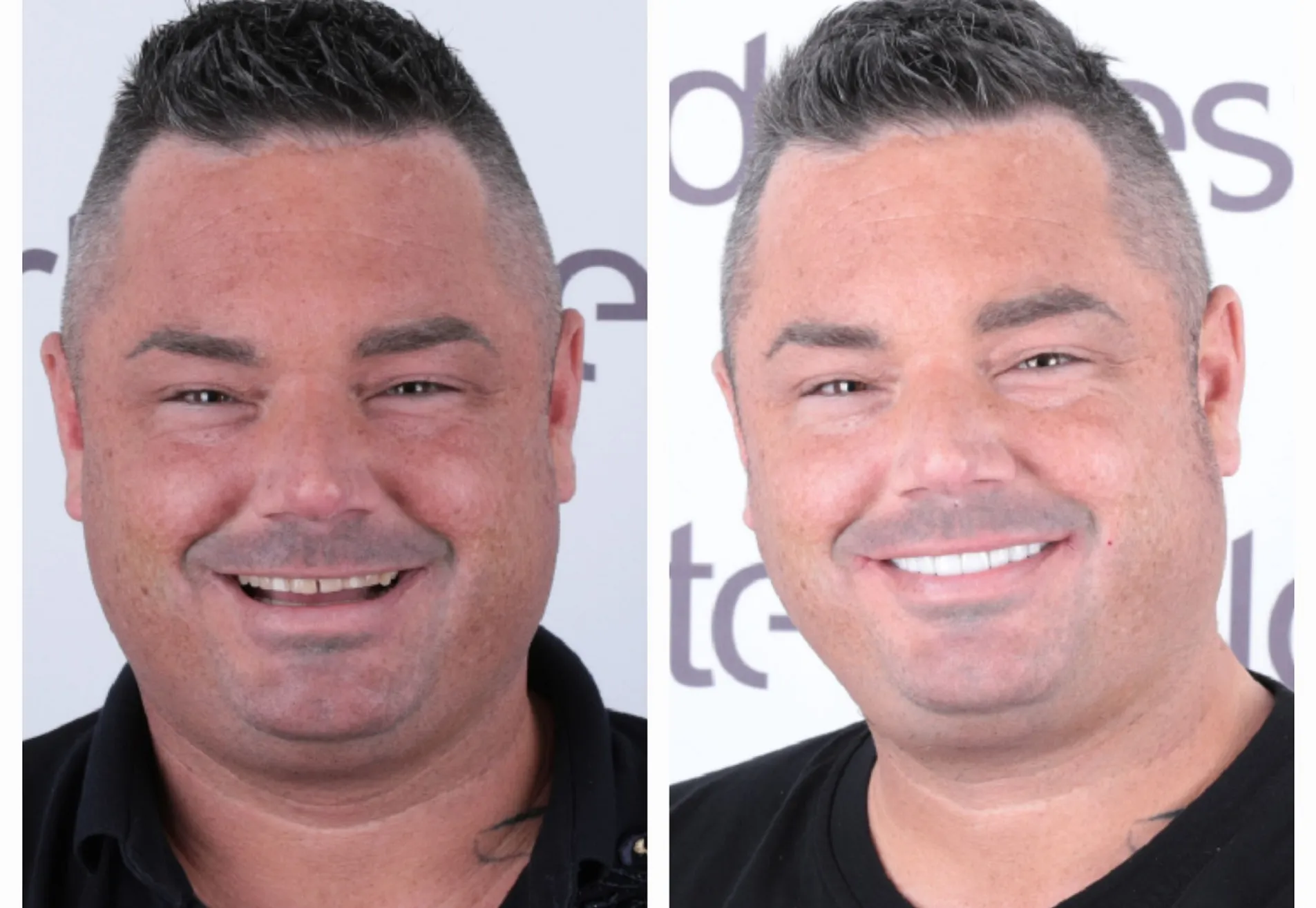 Brian, ik heb eindelijk die Hollywood Smile