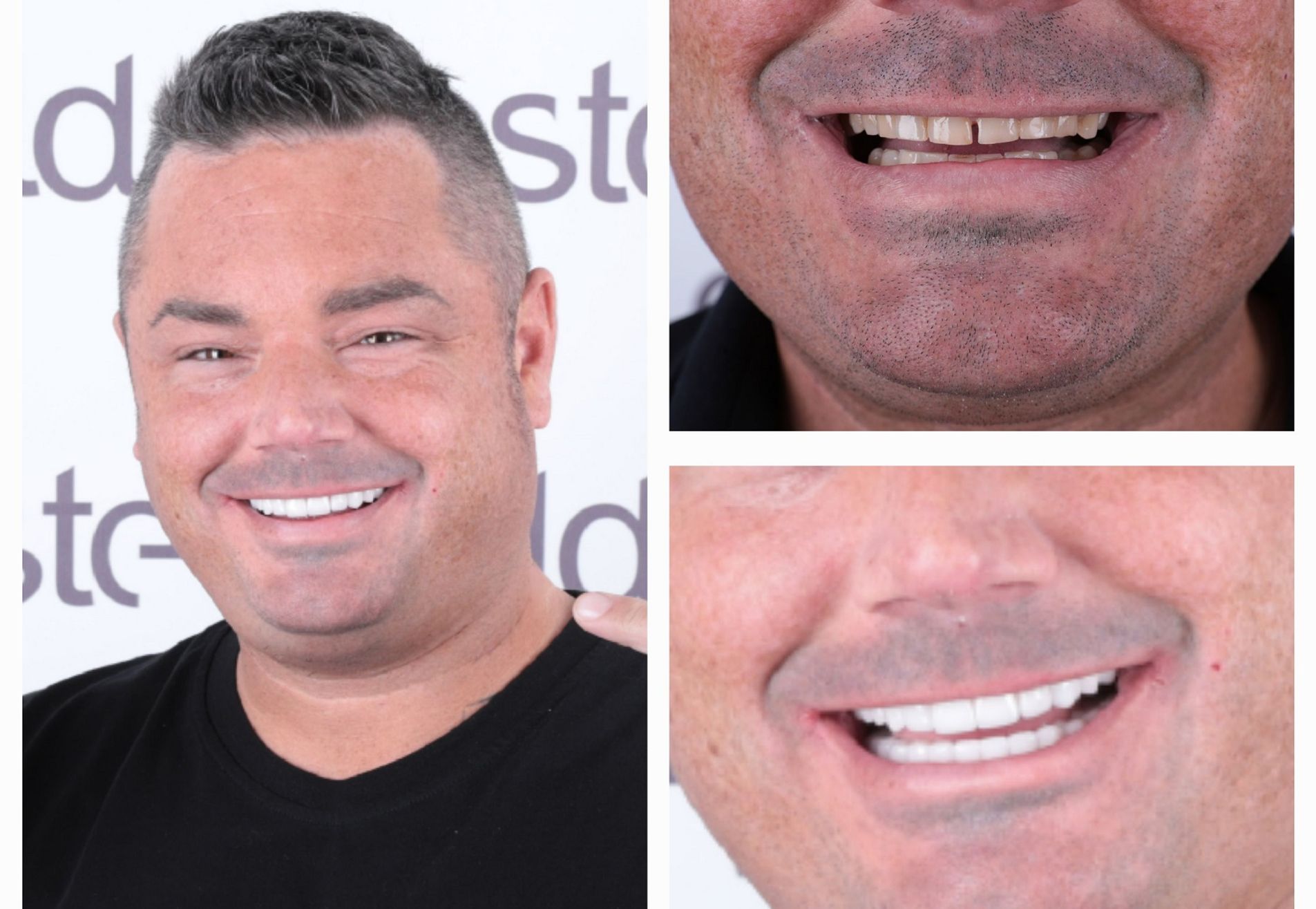 Brian, ik heb eindelijk die Hollywood Smile
