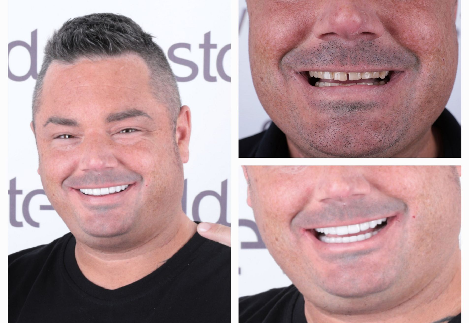 Brian, ik heb eindelijk die Hollywood Smile