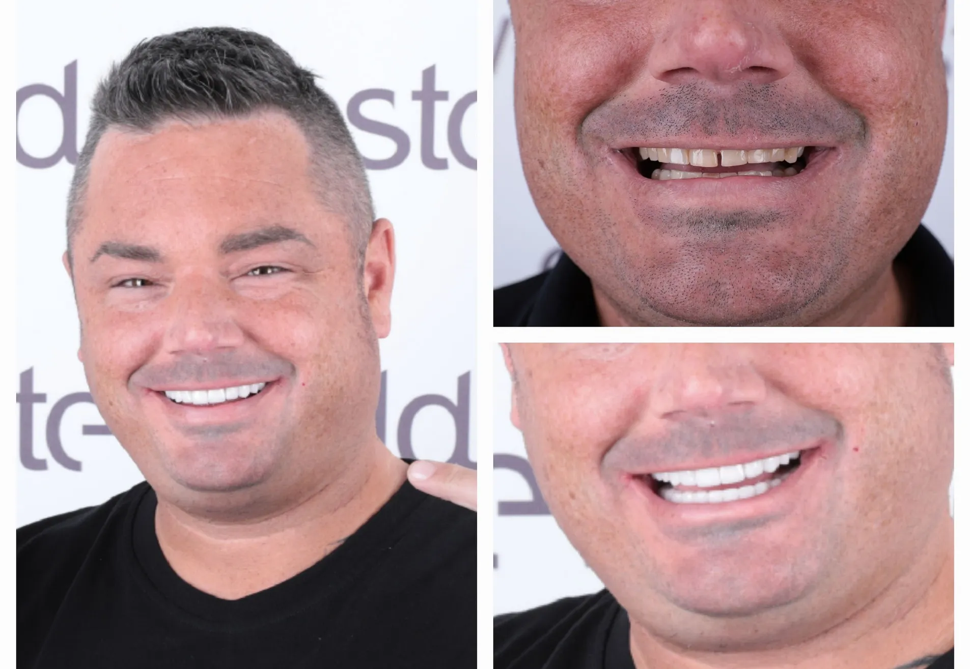 Brian, ik heb eindelijk die Hollywood Smile