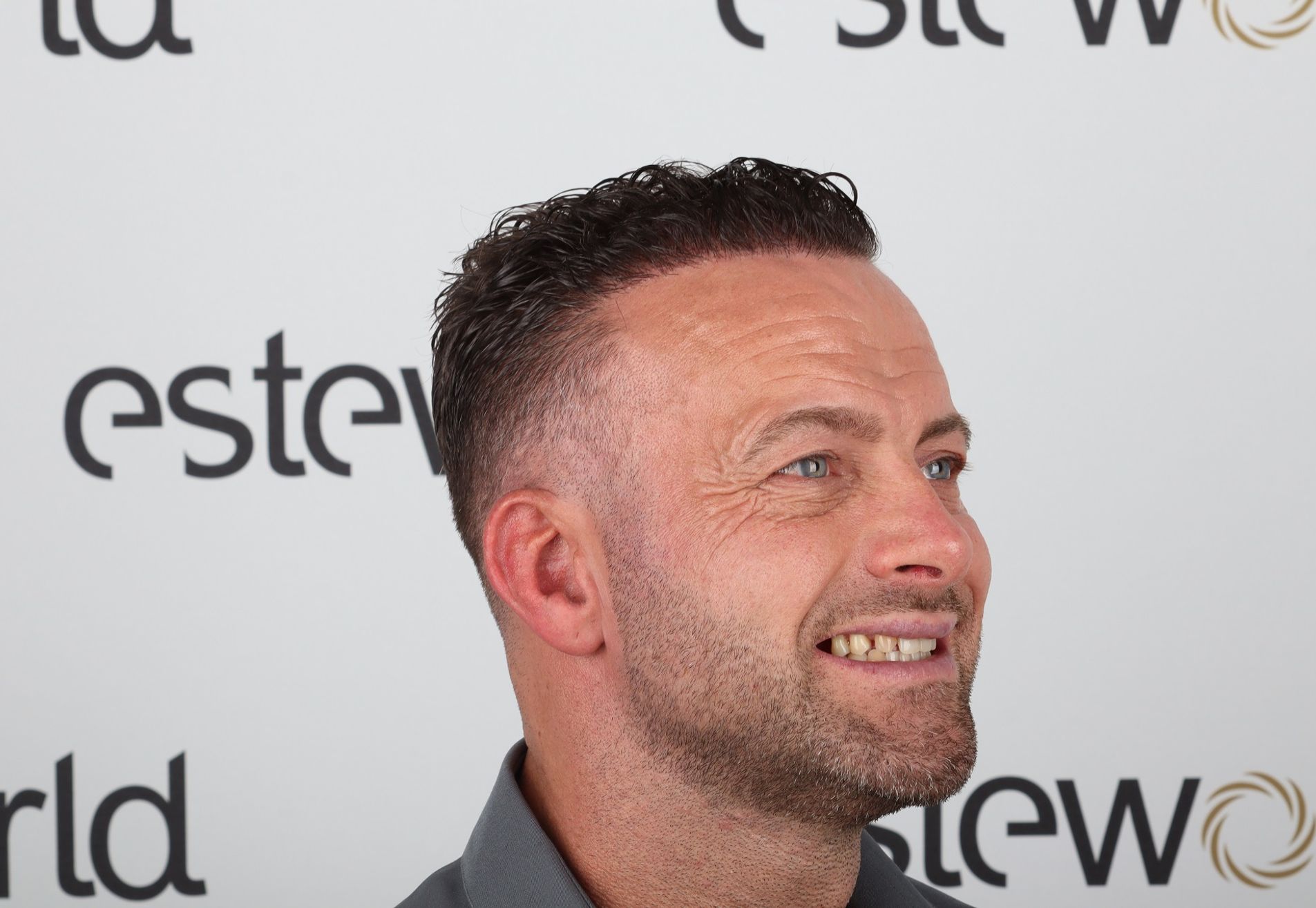 Na een geslaagde haartransplantatie nu Tanden