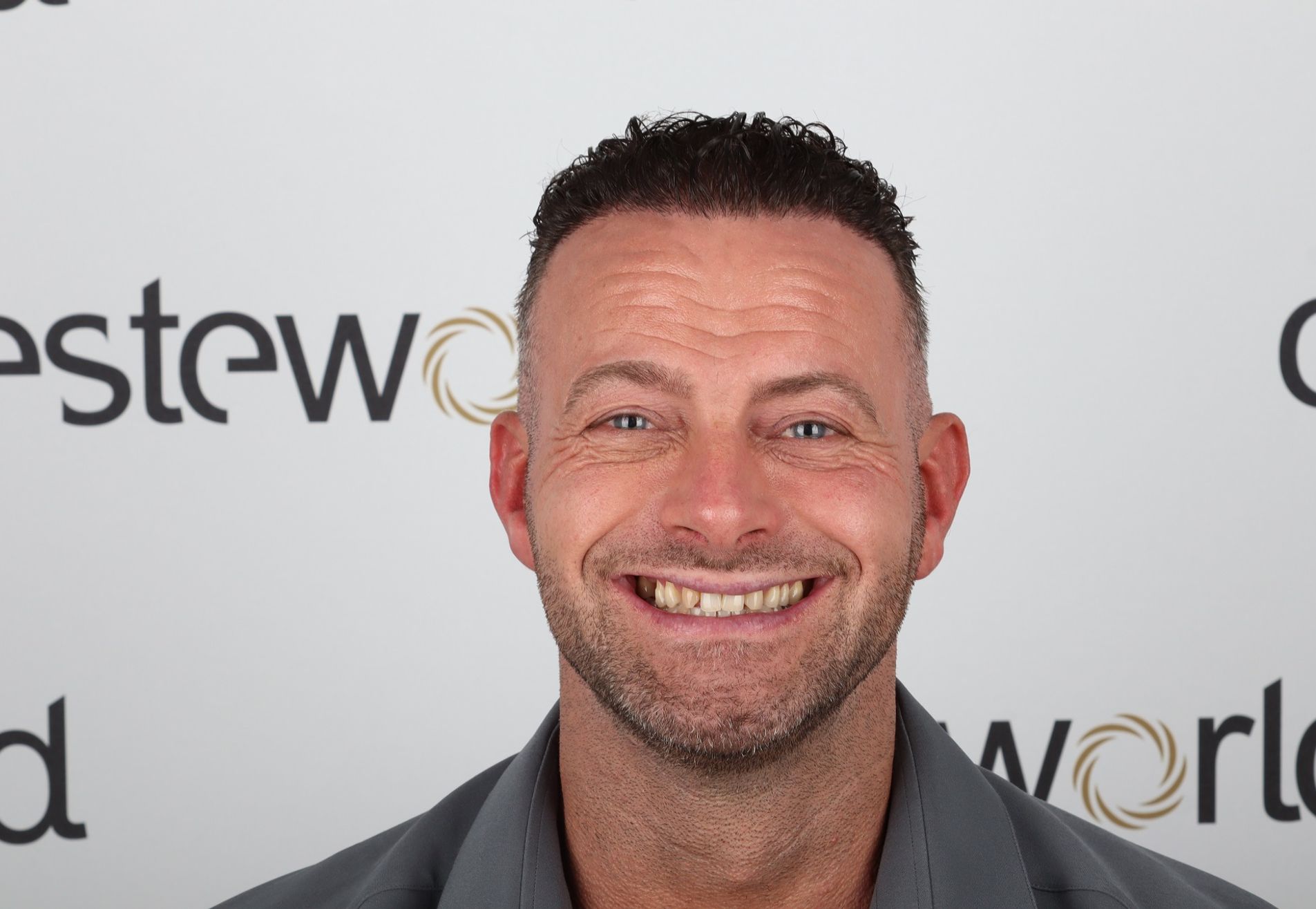 Na een geslaagde haartransplantatie nu Tanden