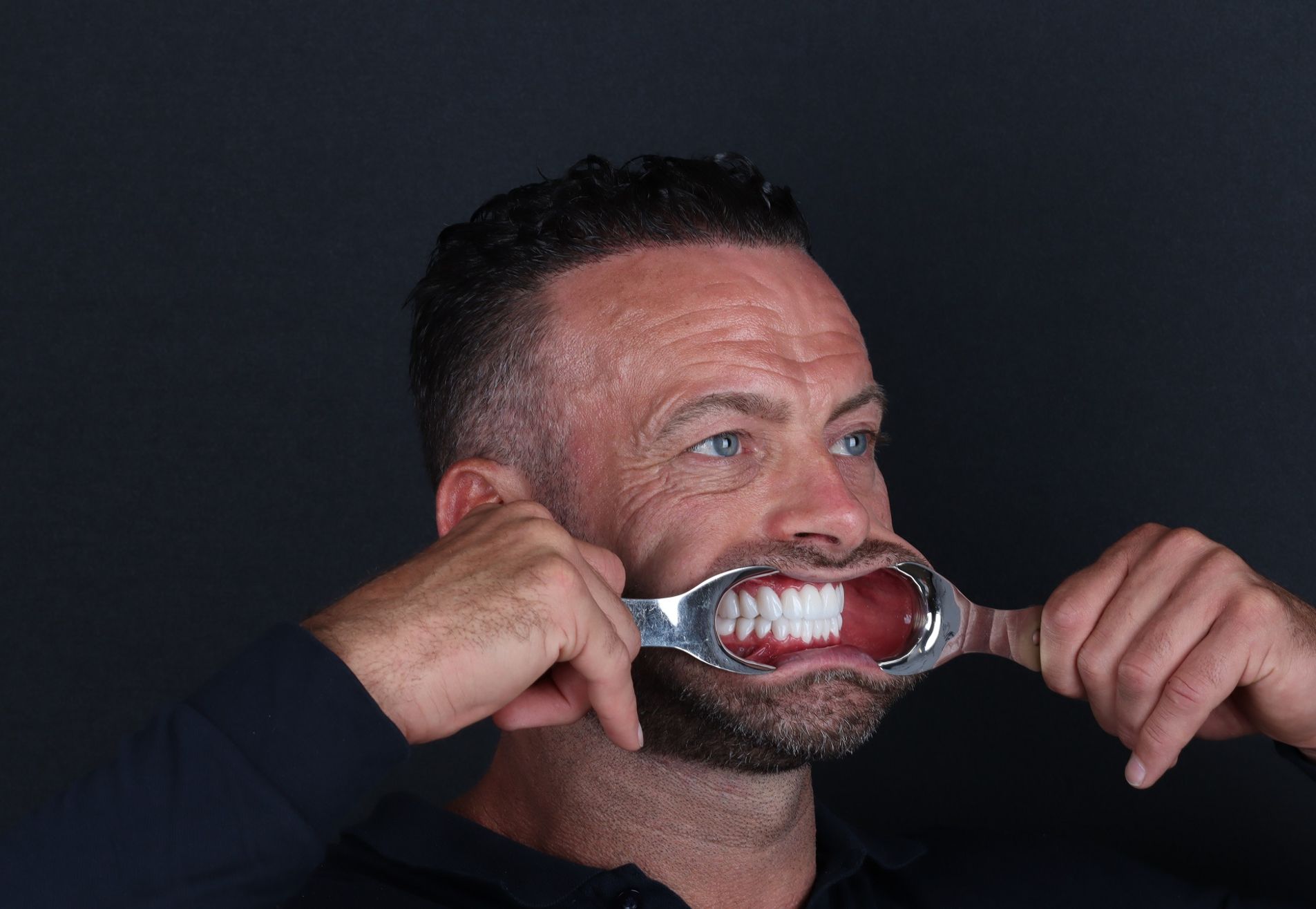 Na een geslaagde haartransplantatie nu Tanden