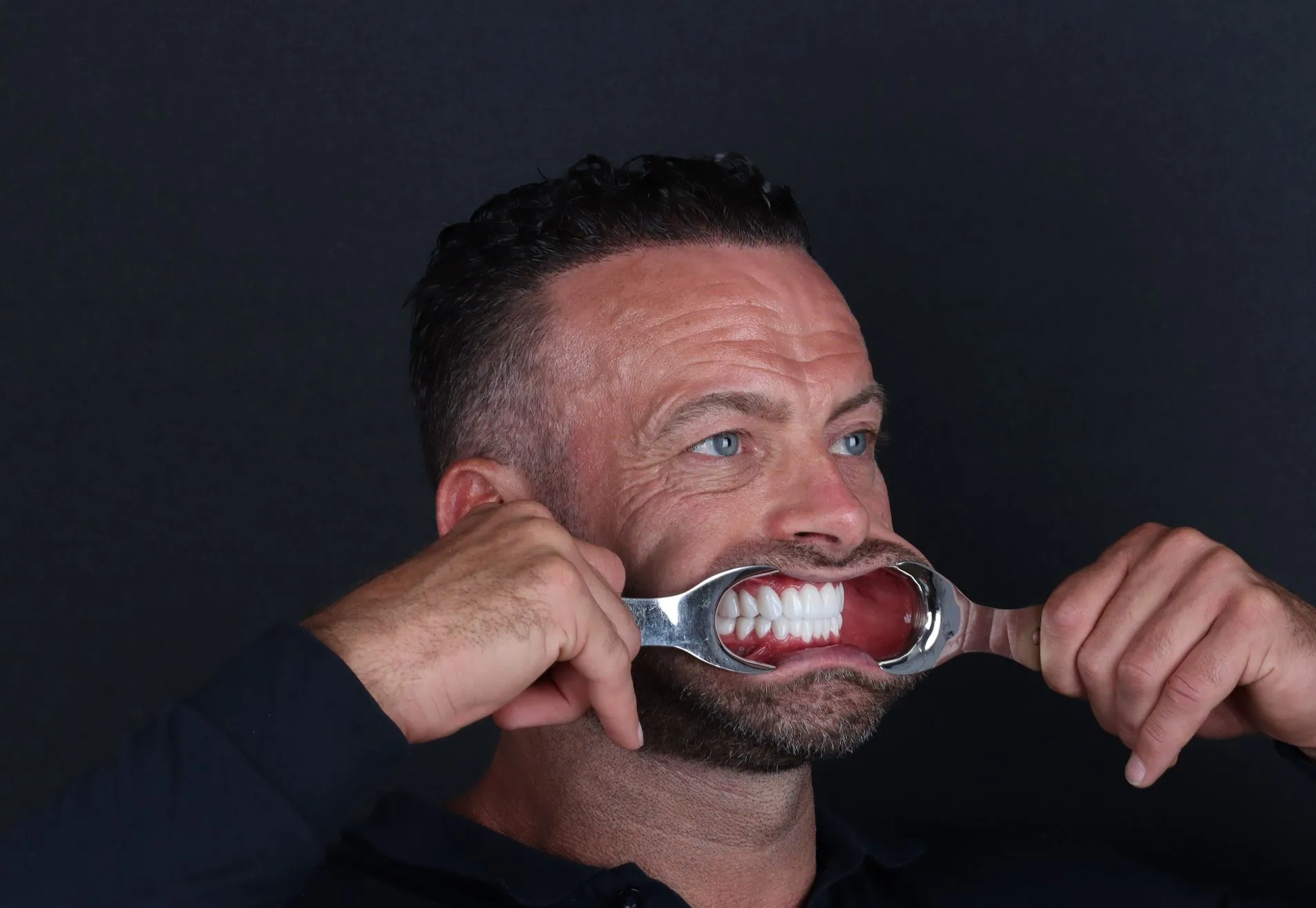 Na een geslaagde haartransplantatie nu Tanden