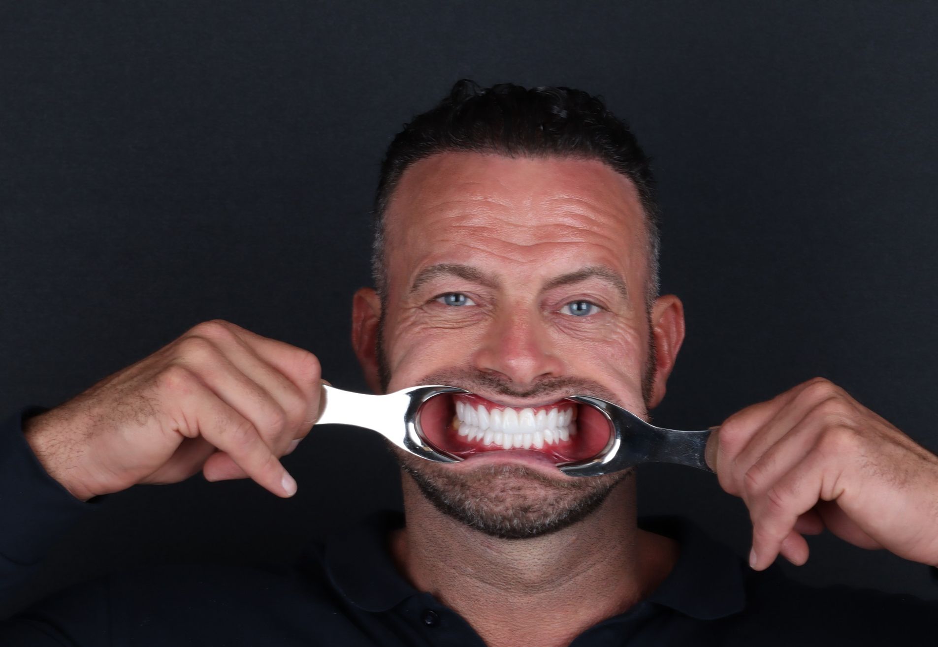 Na een geslaagde haartransplantatie nu Tanden