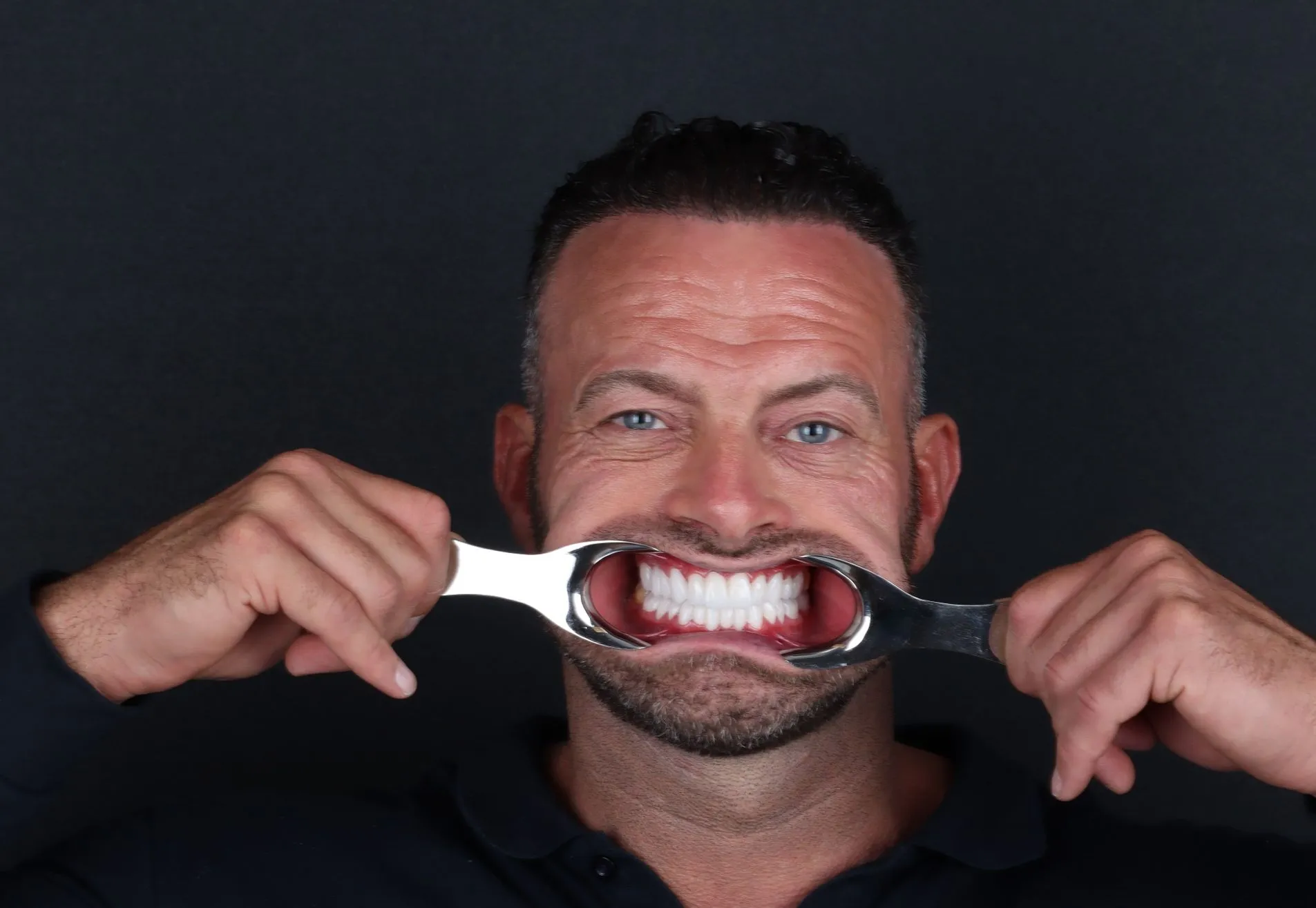Na een geslaagde haartransplantatie nu Tanden