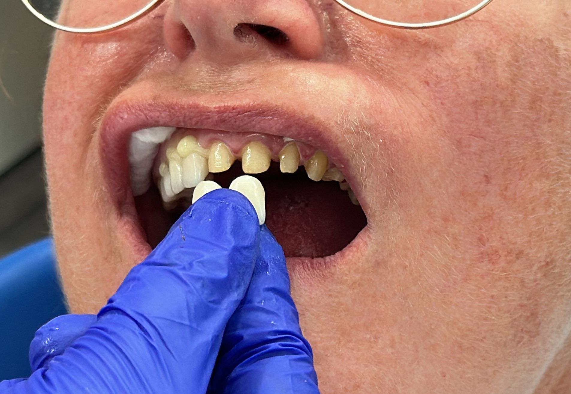 Ik heb weer een keurig gebit