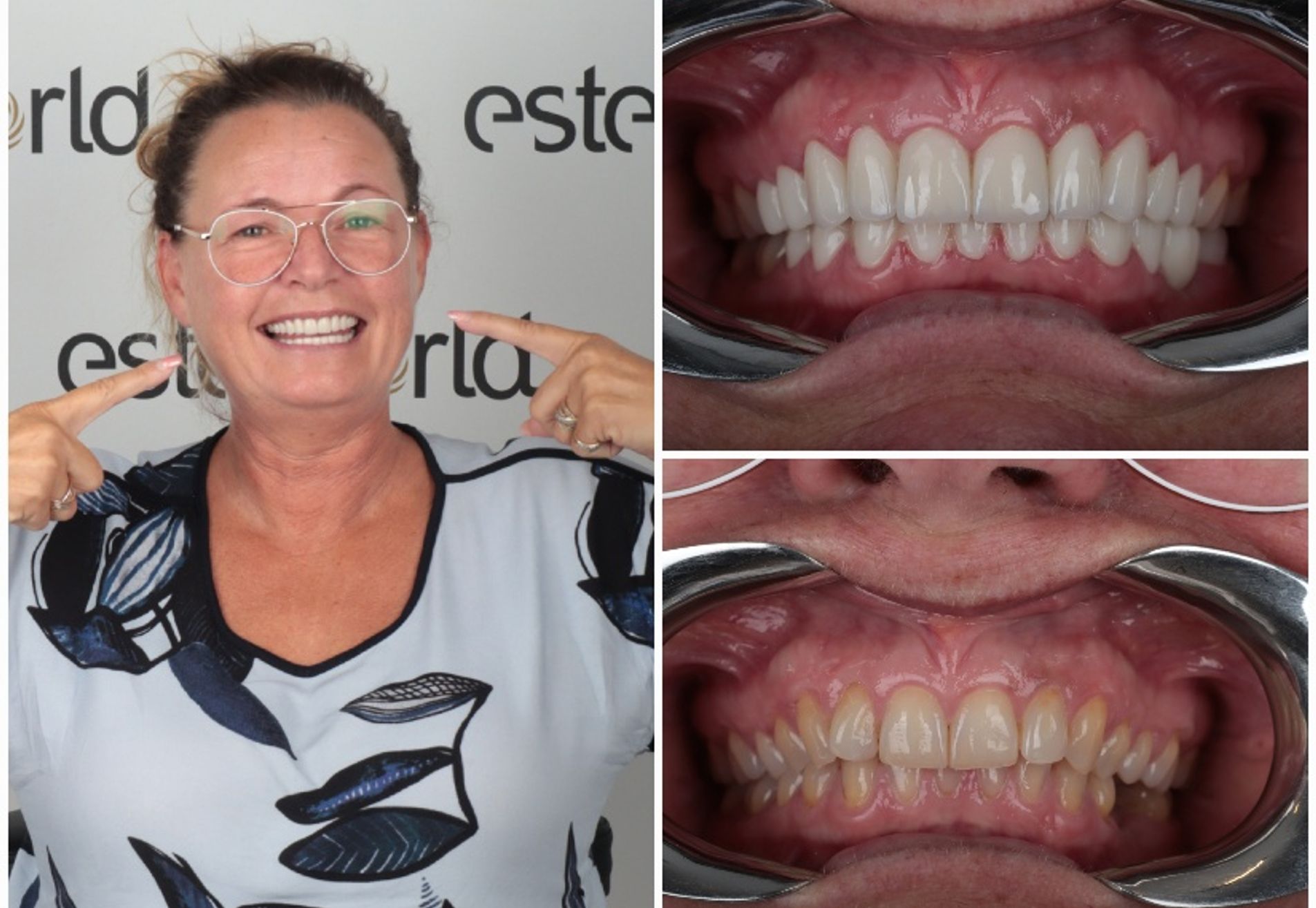 Ik heb weer een keurig gebit