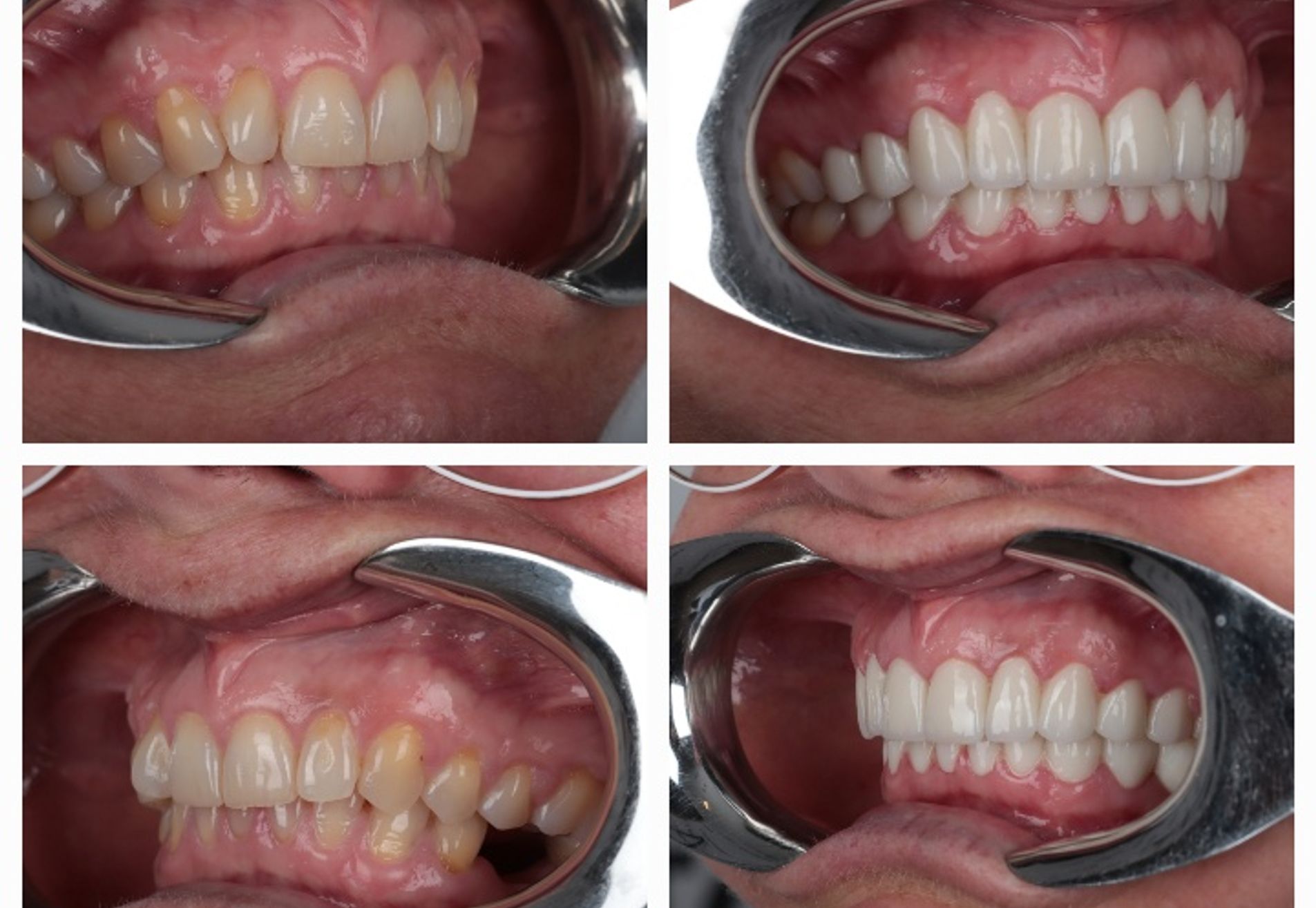 Ik heb weer een keurig gebit