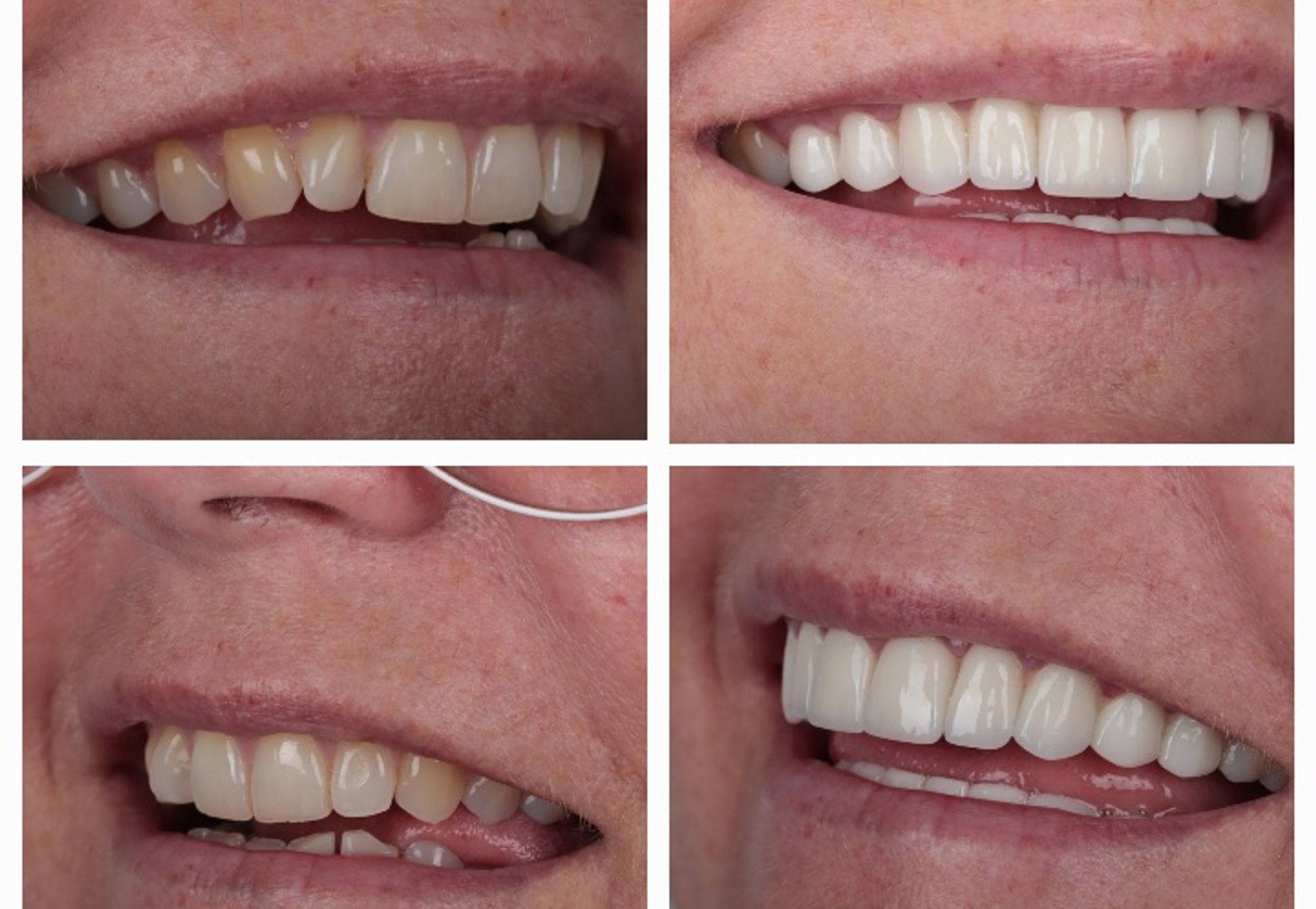 Ik heb weer een keurig gebit