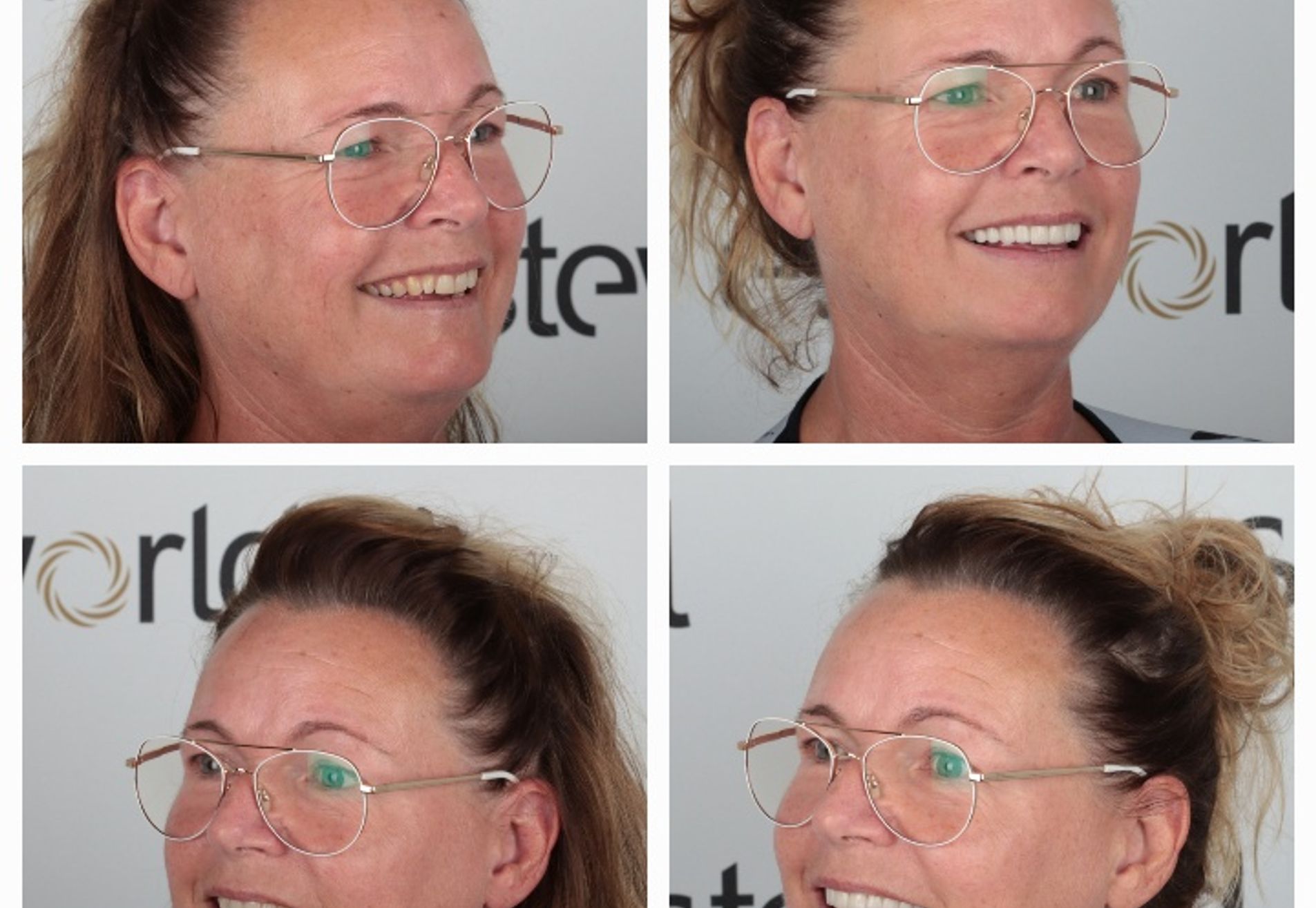 Ik heb weer een keurig gebit