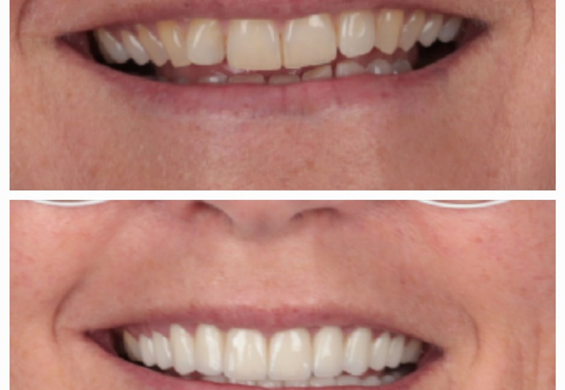 Ik heb weer een keurig gebit