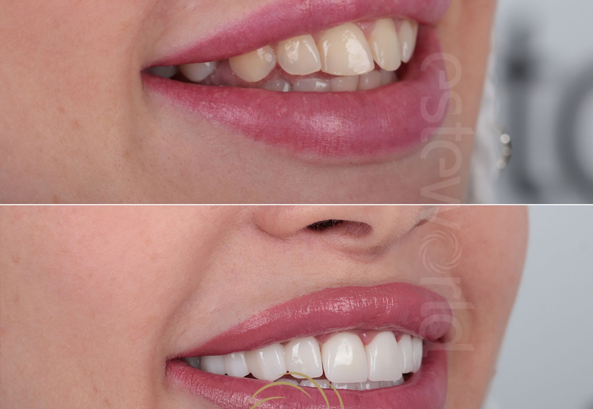 Jody, zelfvertrouwen door mijn smile