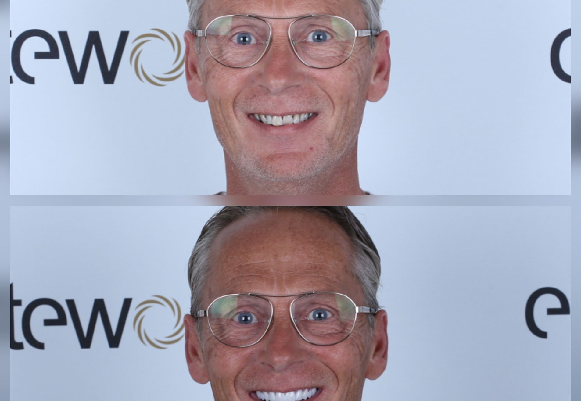 Alexander, zwak gebit en jaren gerookt