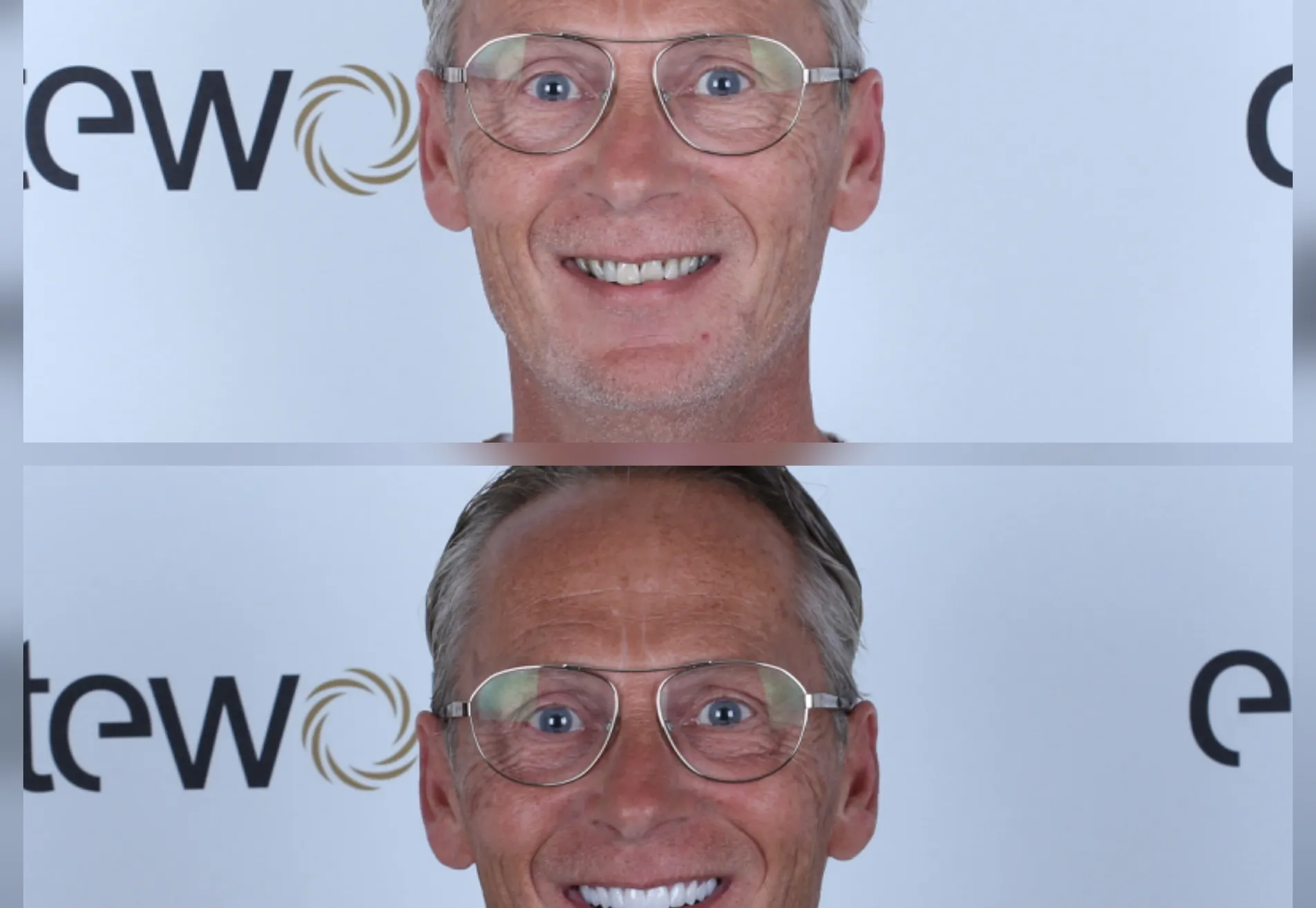 Alexander, zwak gebit en jaren gerookt