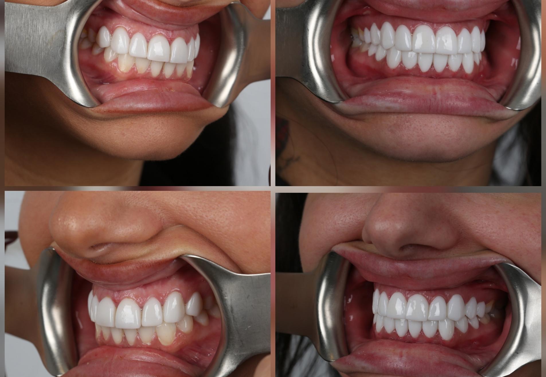 Influencer Ayleen, facings in NL niet mooi gedaan. Nu wel!