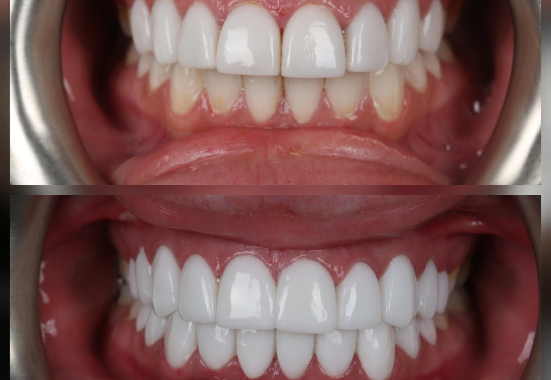 Influencer Ayleen, facings in NL niet mooi gedaan. Nu wel!