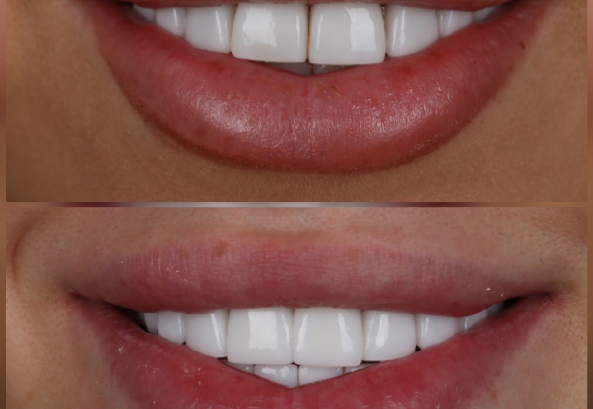 Influencer Ayleen, facings in NL niet mooi gedaan. Nu wel!