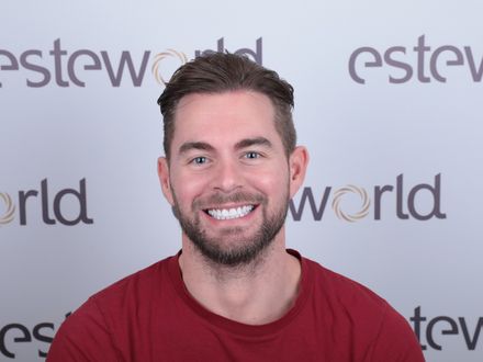 Marco,na succesvolle haartransplantatie nu naar de tandarts