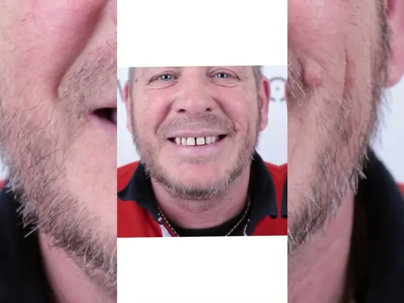 Lizant, mijn gebit voor Esteworld was een ramp